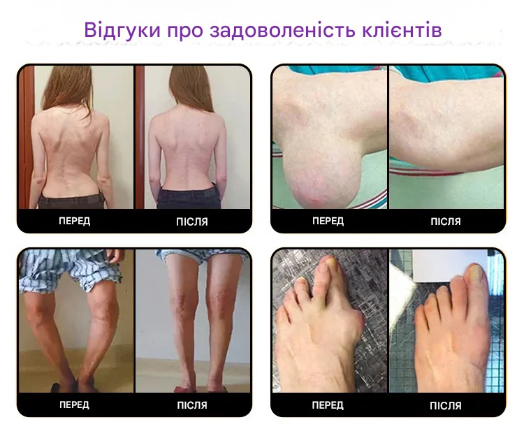 ГЕЛЬ ДЛЯ СУГЛОБІВ, РЕКОМЕНДОВАНИЙ ЛІКАРЕМ ГЕЛЬ ДЛЯ СУГЛОБІВ, РЕКОМЕНДОВАНИЙ ЛІКАРЕМ